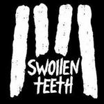 Swollen Teeth