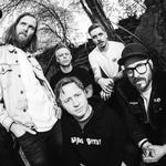 Exploding Head Syndrome