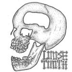 Loose Tooth