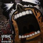 Hemorage